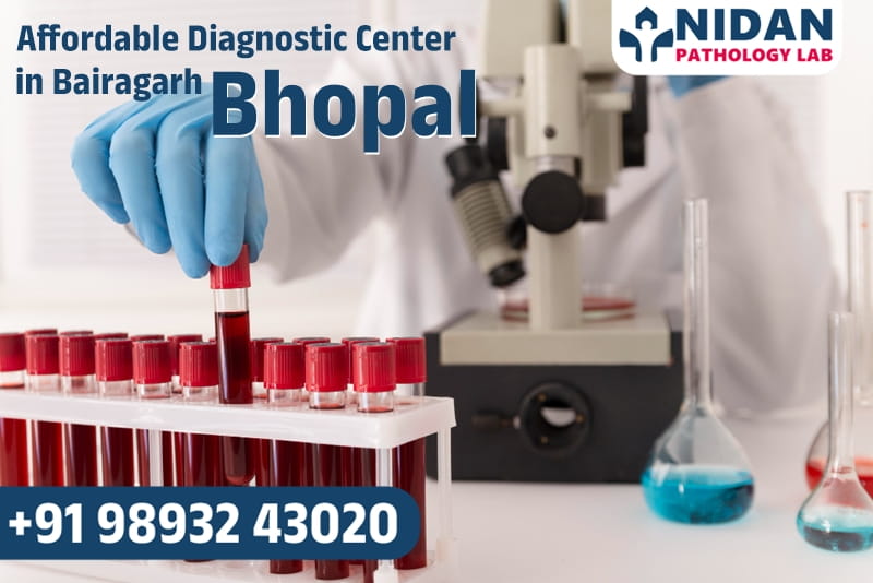 Affordable Diagnostic Center in Bairagarh Bhopal