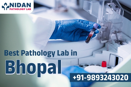 Best Pathology Lab in Bhopal