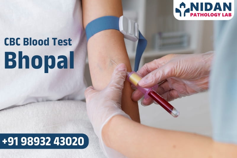 CBC Blood Test in Bhopal