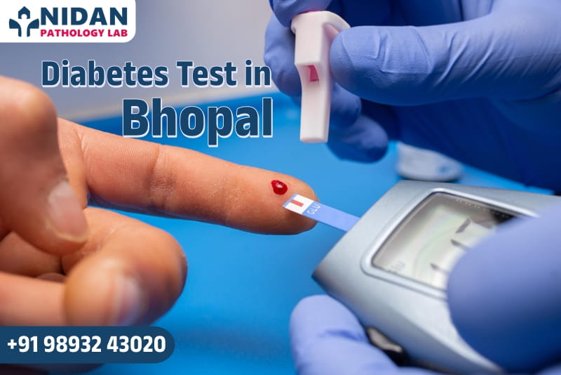 Diabetes Test in Bhopal