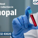 Blood Sample Collection in Bhopal