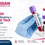 Accurate blood test services in Bhopal with certified diagnostics and quick reports.