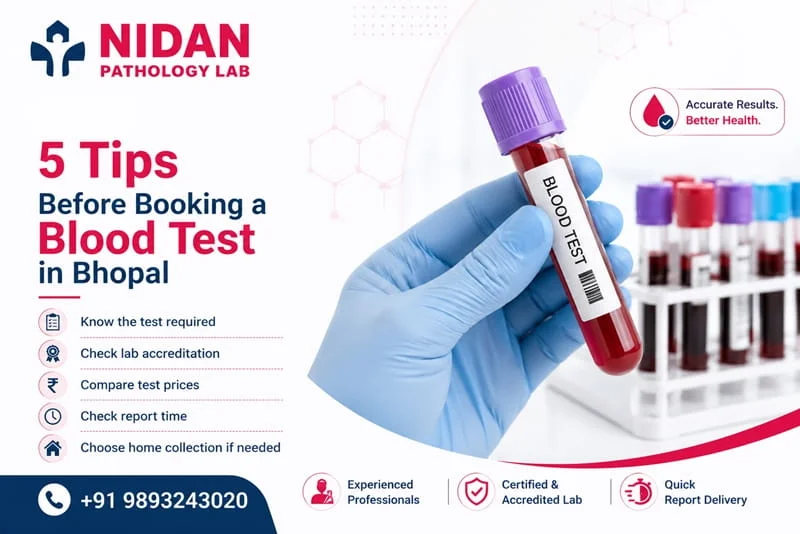 Accurate blood test services in Bhopal with certified diagnostics and quick reports.