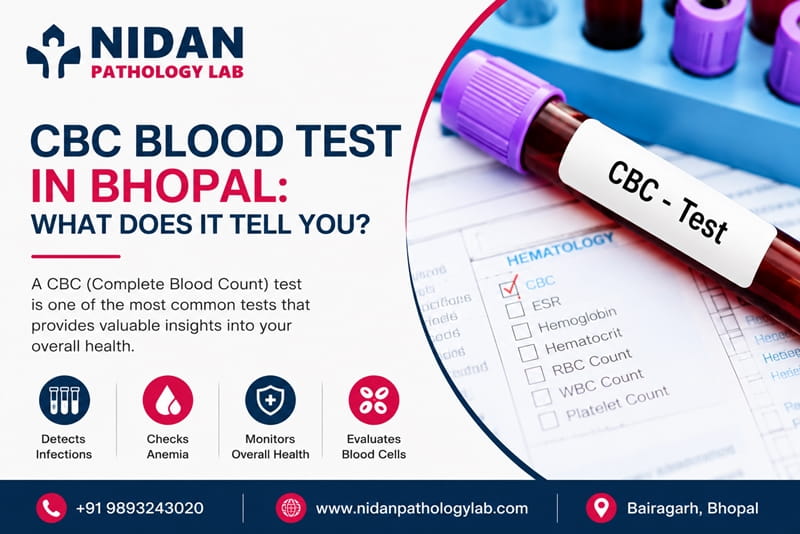 CBC blood test in Bhopal at Nidan Pathology Lab showing complete blood count report with doctor