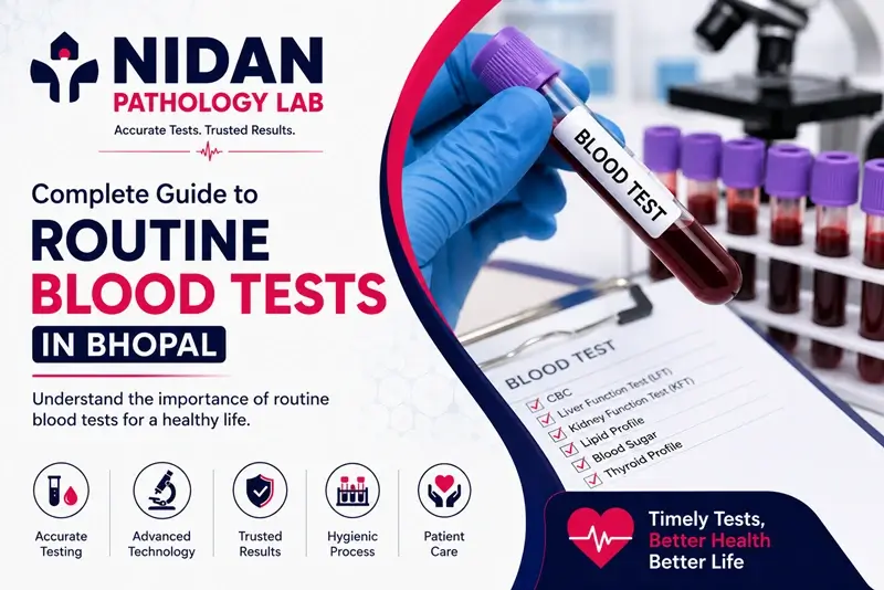 Best Blood Test in Bhopal - Nidan Pathology Lab Diagnostic Centre